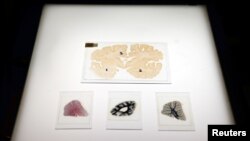 FILE - Microscopic slides of human brain are seen at the Multiple Sclerosis and Parkinson’s UK Tissue Bank at Imperial College London, Britain, June 3, 2016. 