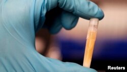 Seorang asisten laboratorium memegang sampel urine beku sebelum disimpan di Biobank, tempat penyimpanan sampel darah dan urine terbesar di dunia, dekat Manchester, bagian utara Inggris, 18 Maret 2018. 