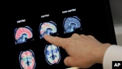 Seorang dokter menunjuk foto PET scan otak di Banner Alzheimers Institute di Phoenix, 14 Agustus 2018.