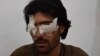 Abdul Baqi, 22, thought his family would help him get married. Instead, his father and four brothers accused him of violating Islamic values and removed his eyes to punish him.