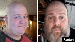 Selfies of Ed Maudlin taken before and after he shaved his beard during a lockdown to prevent coronavirus disease (COVID-19) spread in Indianapolis, Indiana, U.S., March 24, 2020. (Ed Maudlin/Handout via REUTERS)