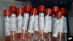 Vials used in the test to detect the presence of COVID-19 are seen at a testing site affiliated with the Methodist Health System, in Omaha, Neb., Friday, April 24, 2020.