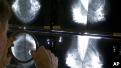 Bác sĩ đang kiểm tra phim chụp X-quang của bệnh nhân ung thư vú.