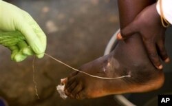 A technician removes a guinea worm from a child's foot at health center in Ghana, 2007.