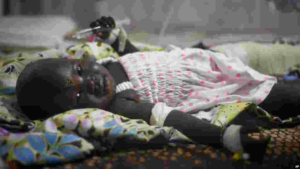 Uma menina de 13 meses, Nyalou Thong, sobrevivente da queda do avião Antonov, é atendida num hospital de Juba, Sudão do Sul, 5 Novembro 2015. (AP Photo/Jason Patinkin)&nbsp;