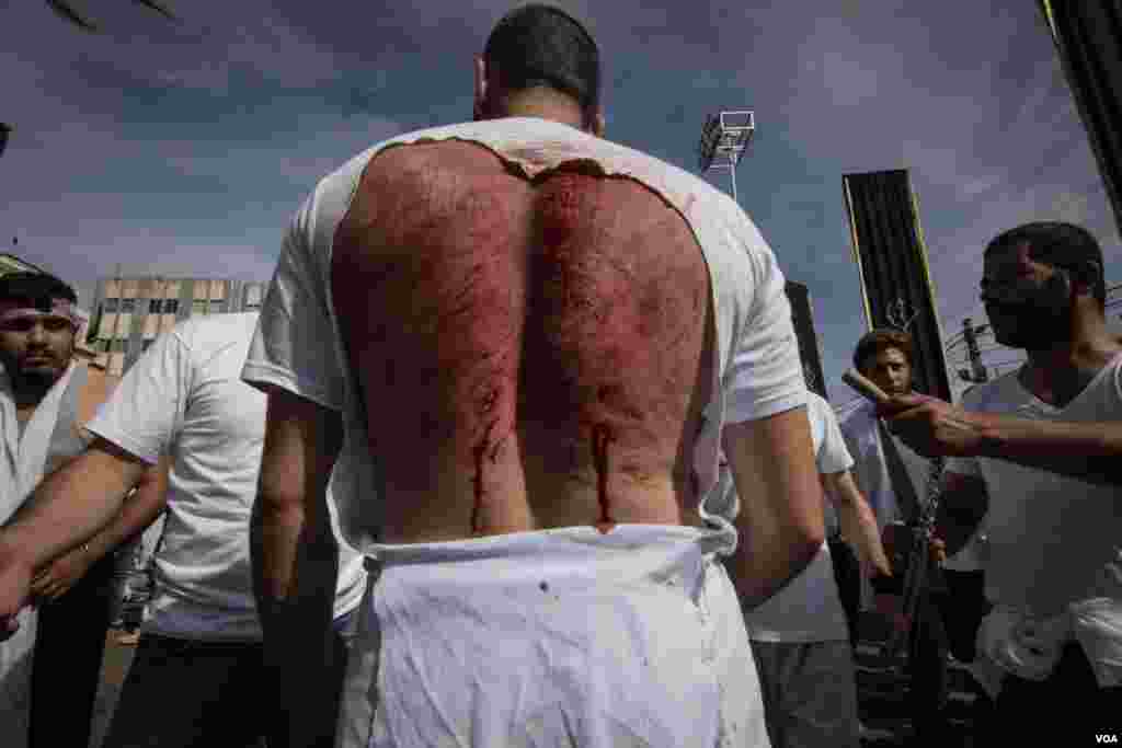 As well as bloodletting from the head, others flay themselves to mark Ashura. However, both are practiced by only a small minority of Shi'ites in Lebanon. (J. Owens/VOA)