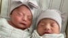 Twin California Babies Born in Different Years