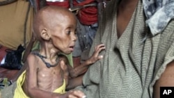 Severely malnourished child from southern Somalia is being held in a makeshift shelter in a refugee camp in Mogadishu, Somalia, September 20, 2011.