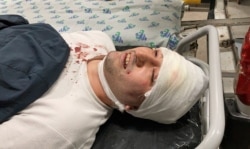 FILE - Blogger Miraziz Bazarov lies on a stretcher upon his arrival at a hospital after he was beaten by a group of unidentified men in Tashkent, Uzbekistan, March 29, 2021.