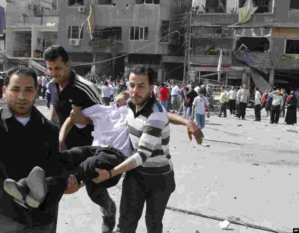 An injured man is carried after an explosion in Damascus.