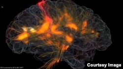 An image of activity in a human brain