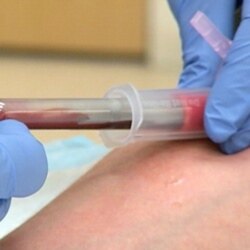 Blood being taken for a test