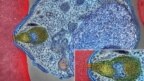 Hình ảnh từ kính hiển vi điện tử của một loại ký sinh trùng sốt rét đang tấn công một tế bào hồng cầu ở người. Các nhà khoa học vừa cảnh báo một loại "siêu ký sinh trùng" kháng sốt rét đã lan từ Campuchia sang Việt Nam.