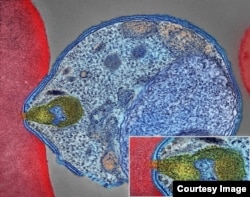 This is a colorized electron micrograph of a malaria-causing Plasmodium parasite, right, attaching to and invading a human red blood cell. The inset shows the attachment point at higher magnification. (Image courtesy of National Institute of Allergy and Infectious Diseases)