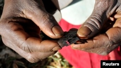 FILE - А traditional surgeon is seen holding razor blades used to carry out female circumcision, also known as female genital mutilation.