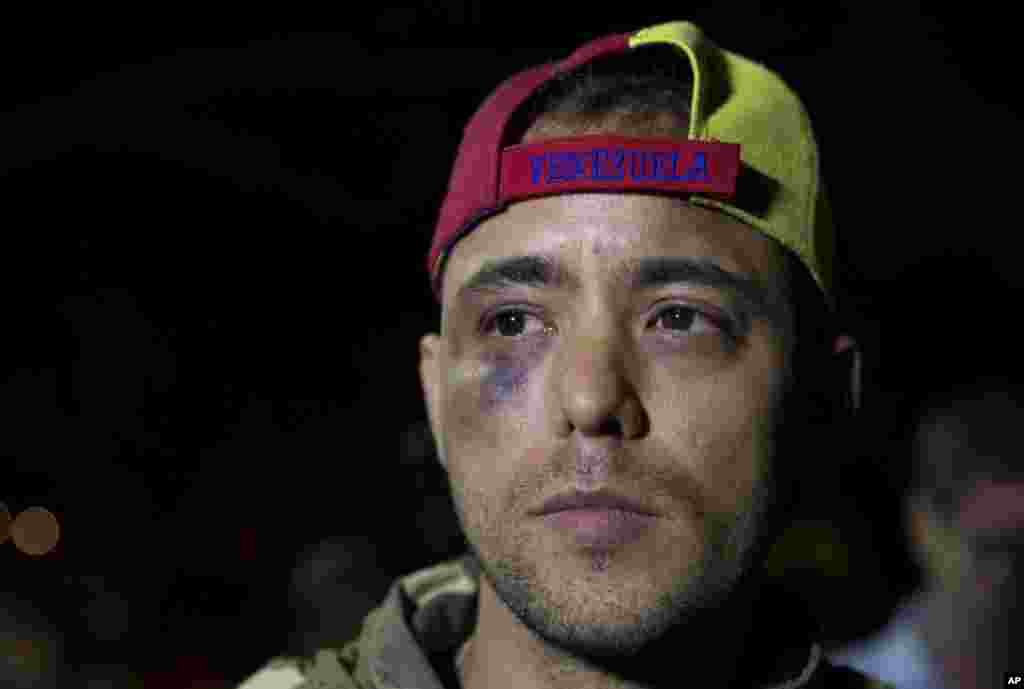 Venezuelan journalist Jesus Medina speaks with press in Caracas, Nov. 7, 2017. Medina said that he had been released following two days of captivity by unidentified men and tortured after photographing criminal gang activities inside a prison.