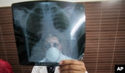 Seorang dokter India memeriksa foto rontgen pasien tuberkulosis di Jammu, India, Senin, 24 Maret 2014. (Foto: AP)