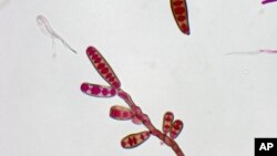 Foto microscópica del hongo asociado a las inyecciones contaminadas causantes del brote de meningitis.