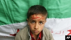 Syrian refugee with word 'Go' on his forehead, in reference to President Bashar al-Assad, northern Lebanon, Nov 12, 2011.
