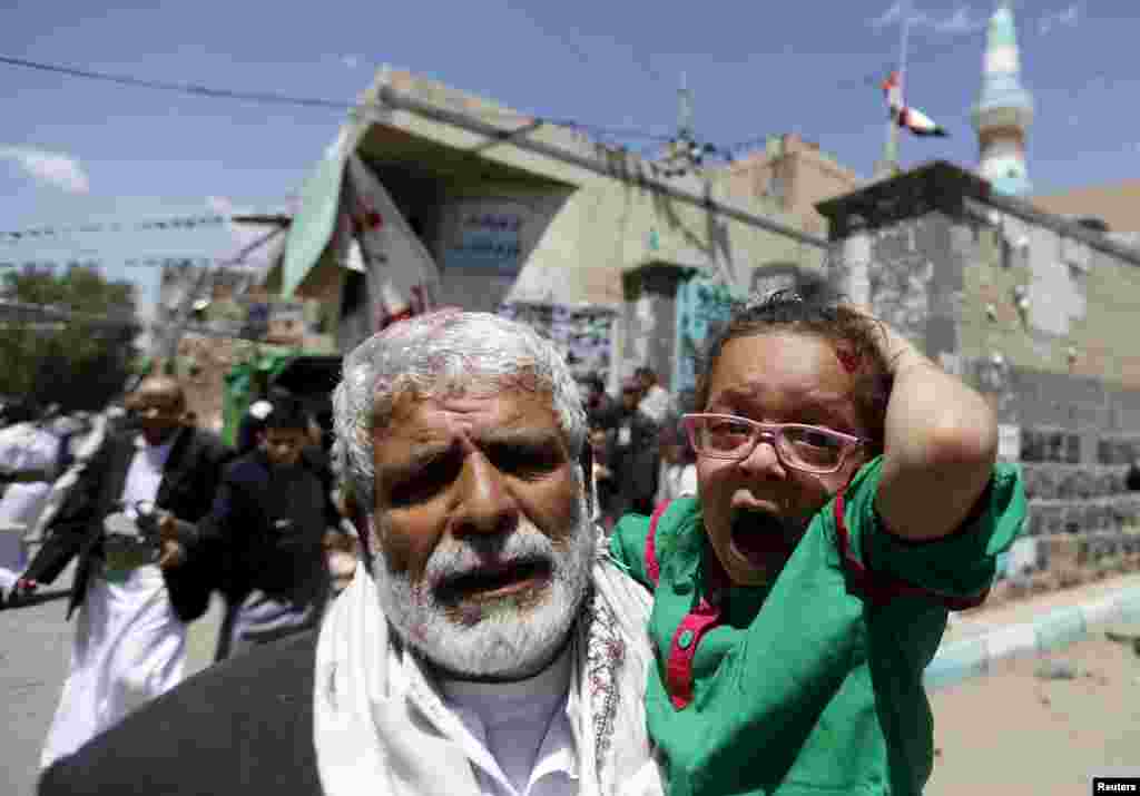 An injured girl reacts as she is carried by a man out of a mosque that was attacked by a suicide bomber in Sanaa, Yemen. At least 16 people were killed when bombers blew themselves up in two mosques during noon prayers. The mosques are known to be used mainly by supporters of the Shi'ite Muslim Houthi group, which has seized control of the government.