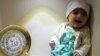 کم سن ایرانی بچی علاج کے لیے امریکی اسپتال میں داخل