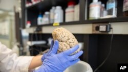 FILE - A researcher holds a human brain in a laboratory.