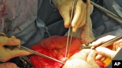 The surgeons sew a piece of small intestine from the transplanted pancreas to Tiffany Buchta's own intestine during her double transplant surgery.