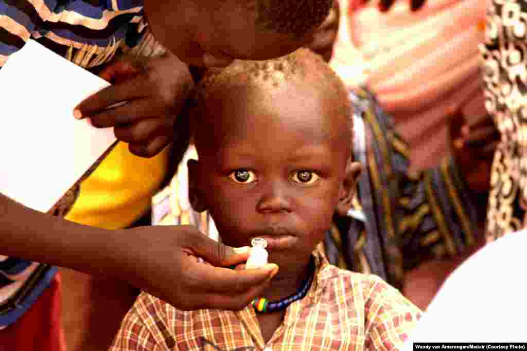 An IDP child takes a dose of oral cholera vaccine at UNMISS Tomping camp in Juba. The World Health Organization says the vaccine is safe for anyone over the age of one year except for pregnant women. 