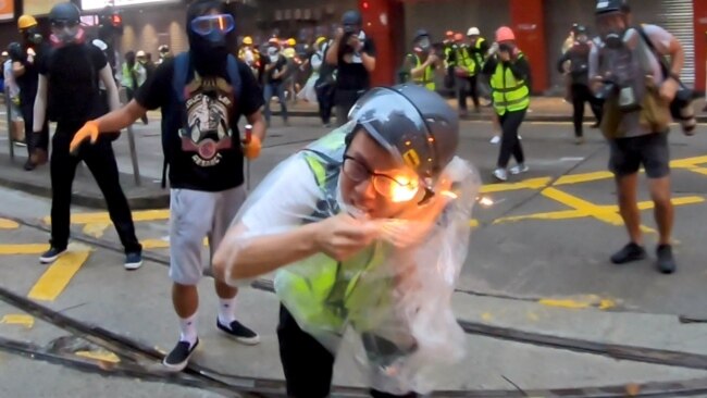 在香港抗議活動中被燃燒裝置擊中受傷的香港記者(2019年10月6日）