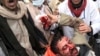 В Йемене расстреляли демонстрацию протеста