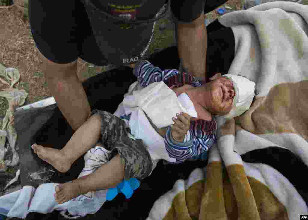 18-month-old Jassem is comforted by an army medic while being treated for shrapnel head injuries at an Iraqi Special Forces 2nd division open air field clinic in the Samah neighborhood of Mosul.