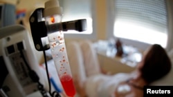 FILE - A patient receives chemotherapy treatment for breast cancer at the Antoine-Lacassagne Cancer Center in Nice, July 26, 2012. 