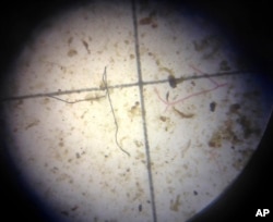 FILE - A possible plastic microfiber, left, is shown through a microscope during an examination of nearby ocean water in Key Largo, Florida, Feb. 7, 2017.