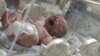 Doctors Warn of Global C-Section ‘Epidemic’