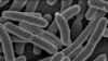 Pháp điều tra 2 trường hợp E. coli mới