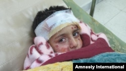 Seorang anak dirawat di rumah sakit karena terluka akibat serangan bom rumpun di Suriah (1/3).