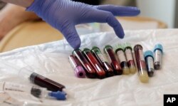 FILE - In this photo taken March 21, 2017, a nurse reaches for blood samples taken from a patient receiving a kind of immunotherapy known as CAR-T cell therapy at the Fred Hutchinson Cancer Research Center in Seattle.