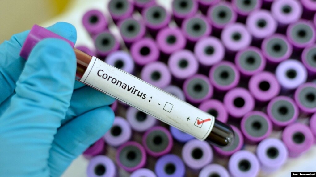 Azərbaycanda 40 jurnalist COVİD-19-a yoluxub, onlardan 5-i vəfat edib