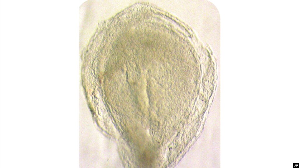 This image from Oxford University shows a human embryo 16-19 days after fertilization. The embryo is undergoing a process called gastrulation, when different cell types are generated and distributed to specific places in the embryo. (University of Oxford via AP)