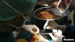 Surgeons clean a kidney after an operation 