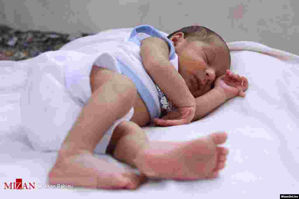 تولد نوزاد ۲۴ انگشتی در شهرستان گناباد عکس: محسن رحیمی 