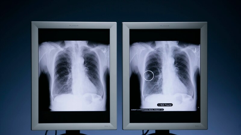'Ray of Hope': New Advances in Fighting Range of Cancers...