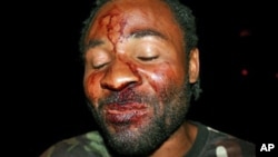 Mário Domingos, organizador de uma manifestação em Luanda em Março de 2012 agredido por desconhecidos, alegadamente dos serviços de segurança