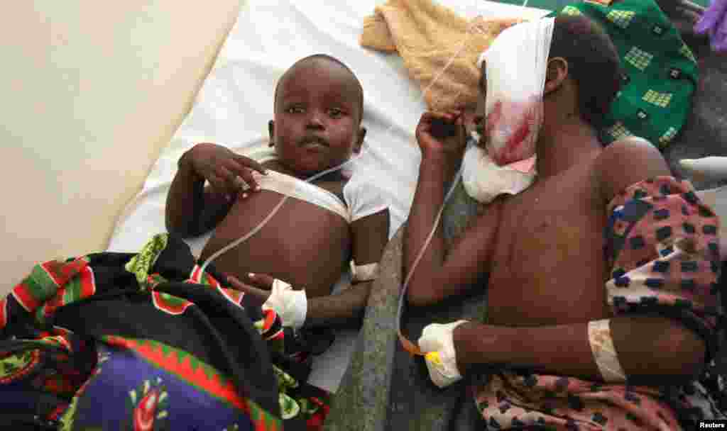 Children injured during an attack in their village in Tana River district receive treatment inside a ward at the Malindi district hospital December 21, 2012.