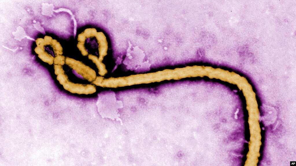 Scientists Discover Cure for Ebola Virus - Voice of America