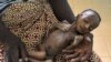 PBB: Kelaparan dan Migrasi Meningkat Akibat Pandemi Covid-19 dan Kemunduran Ekonomi