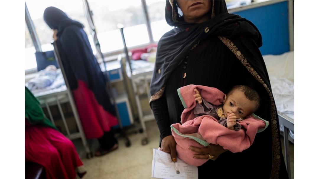 FILE - In this Sept. 15, 2021 file photo, an Afghan woman holds her 5-month-old daughter, Samina, at the malnutrition ward of the Indira Gandhi Children Hospital, in Kabul, Afghanistan.