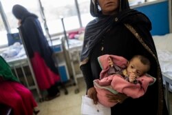 FILE - In this Sept. 15, 2021 file photo, an Afghan woman holds her 5-month-old daughter, Samina, at the malnutrition ward of the Indira Gandhi Children Hospital, in Kabul, Afghanistan.