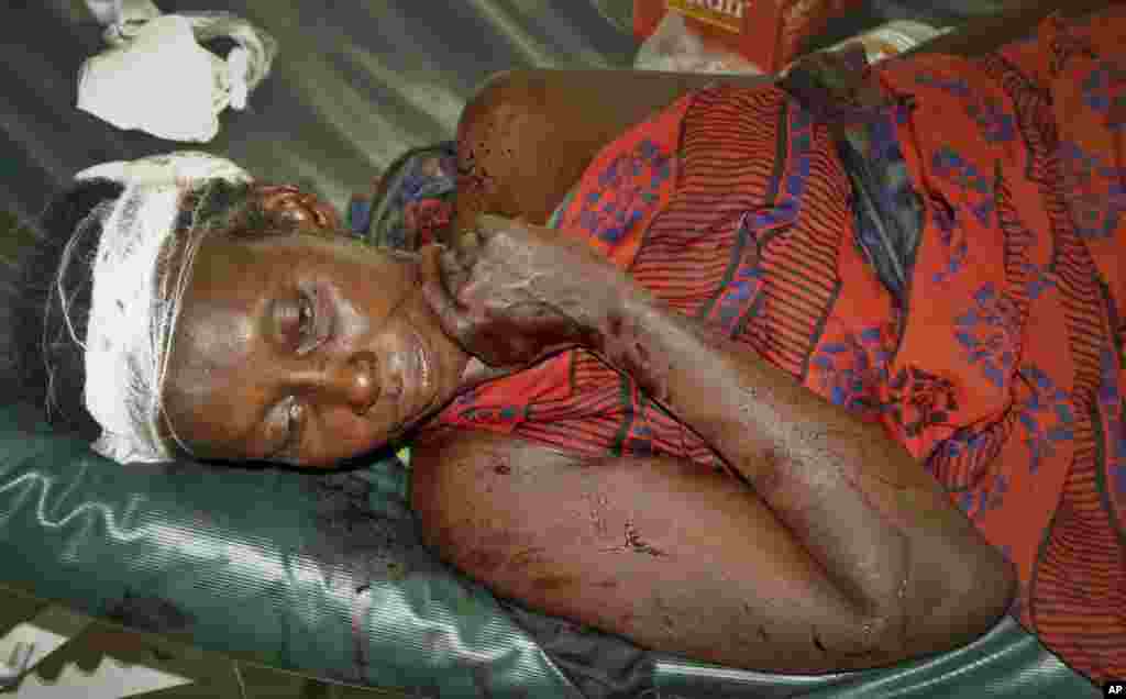An injured woman is treated at the district hospital in Malindi Friday, Dec. 21, 2012, following tribal clashes in Kipao village in the Tana River Delta.