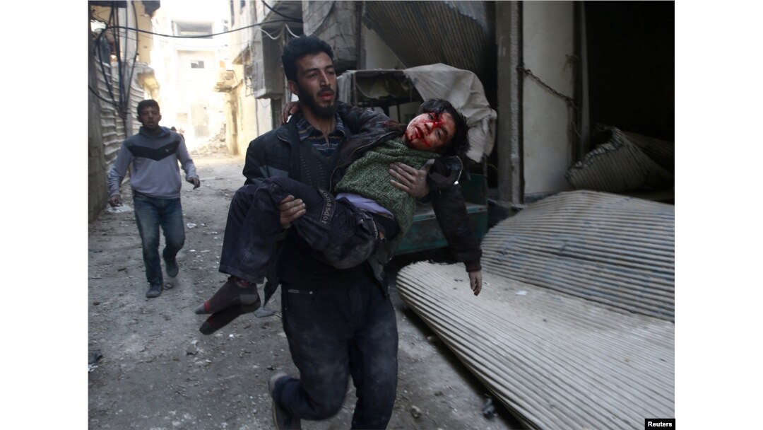 Seorang pria membopong anak laki-laki yang terluka di Kota Hamouriyeh, yang dikuasai dan dan dikepung pemberontak di timur Ghouta, dekat Damaskus, Suriah, 21 Februari 2018.